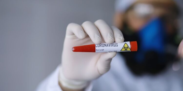 Isolamento del coronavirus allo Spallanzani di Roma: si lavora per cercare la terapia