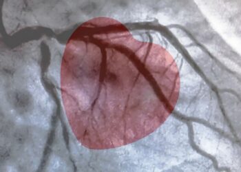 Stenosi aortica: Farà tappa a Salerno Il progetto “ Tavi è Vita”