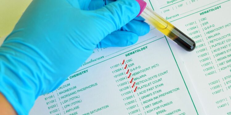 AIL Salerno, 25 anni di vita per la nascita e la crescita dell’ematologia salernitana