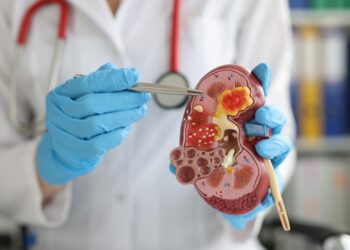 Chirurgia oncologica, l’ASL Salerno primeggia per gli interventi urologici “conservativi”