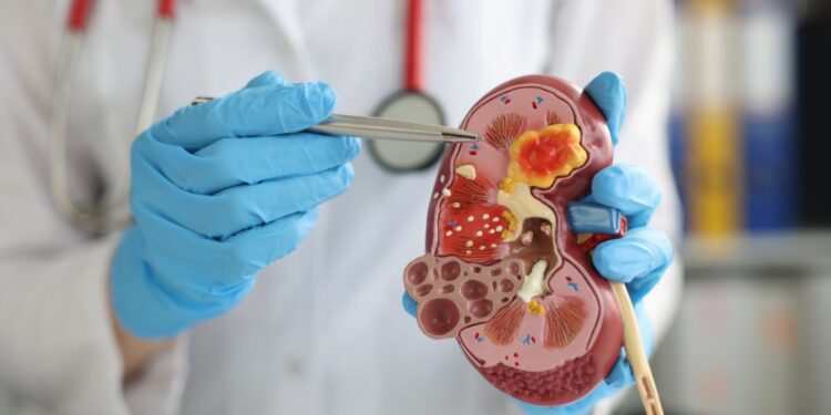 Chirurgia oncologica, l’ASL Salerno primeggia per gli interventi urologici “conservativi”