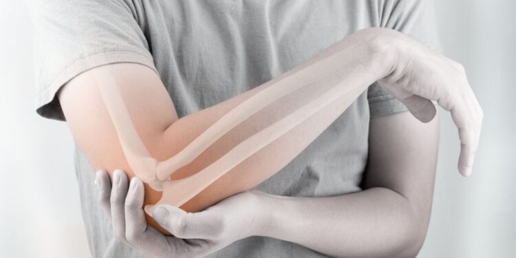 (H) Open Day osteoporosi al Vanvitelli di Napoli