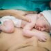 Molinette: “chirurgia da sveglio” salva mamma e feto
