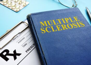 Sclerosi multipla, il virus di Epstein-Barr tra le cause