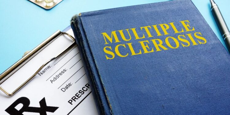 Sclerosi multipla, il virus di Epstein-Barr tra le cause