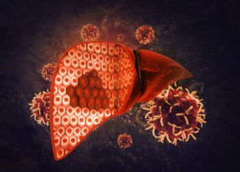 Tumore del fegato, dall’ISS le nuove Linee Guida per un nuovo approccio terapeutico