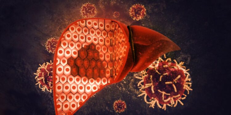 Tumore del fegato, dall’ISS le nuove Linee Guida per un nuovo approccio terapeutico