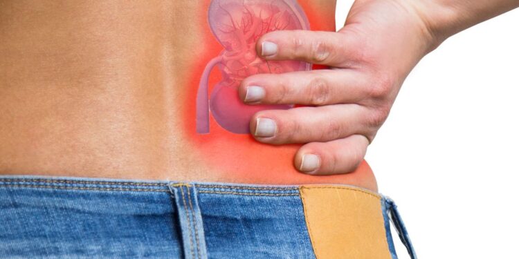 AORN Caserta: intervento di nefroctomia radicale su un 50 affetto da tumore renale