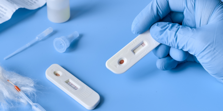 Campania, 100 laboratori salernitani per i test sierologici