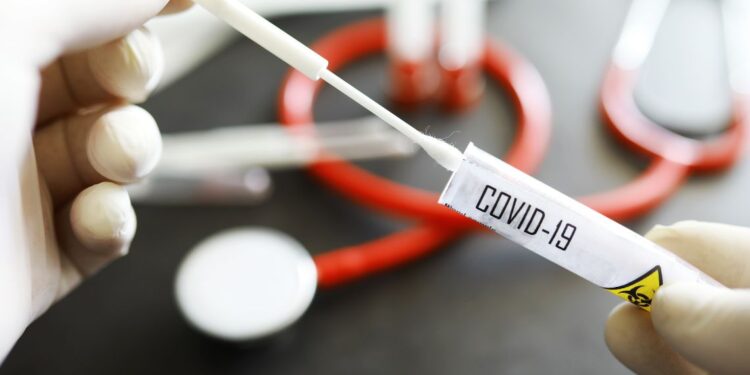 La FIMP chiede all’ASL di prescrivere i tamponi