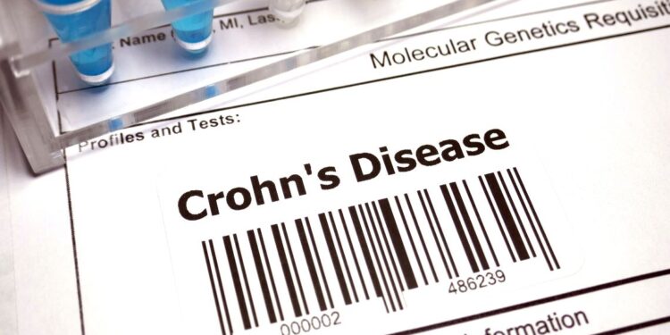 Malattia di Crohn, cinque grandi ospedali italiani nel trial clinico ATTIC