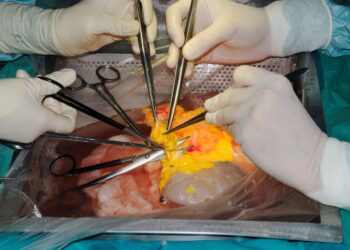 Ospedale Niguarda: 14 trapianti in 10 giorni