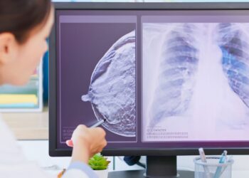 Policlinico di Bari, un software per la diagnosi precoce del cancro al seno