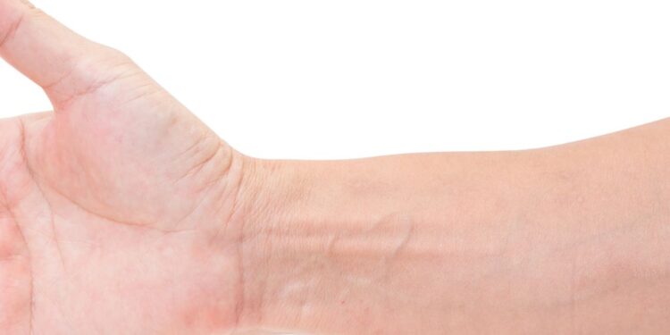 Policlinico di Palermo, reimpianto di un braccio per la prima volta in Sicilia