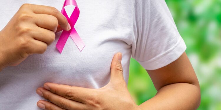 “Progetto Donna” alla Breast Unit dell’AOU Federico II di Napoli