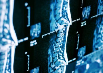 SMA, partiti in Campania gli screening neonatali