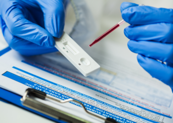 Test sierologici in Campania dal 4 maggio