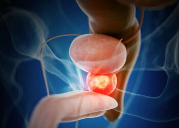 Tumori della prostata, polmone e colon, identificati nuovi marcatori per individuarli