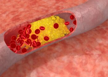 UOC ed UTIC di Mercato S. Severino in studi scientifici internazionali