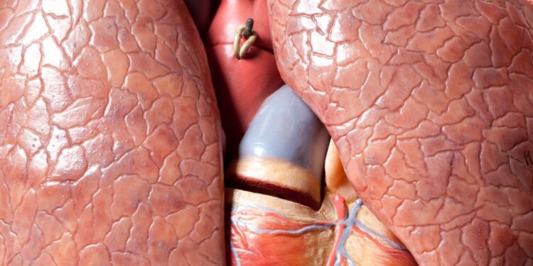 Trapianto domino: Riceve un cuore e due polmoni ed a sua volta dona il suo cuore da vivente ad una seconda ricevente