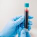Al via in Basilicata progetto “Plasma”