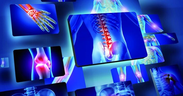 A Salerno Congresso ‘Nuove sfide in Reumatologia: update 2023’