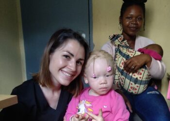 Bambini neri dalla pelle bianca come la luna. A curarli una dermatologa del Pascale