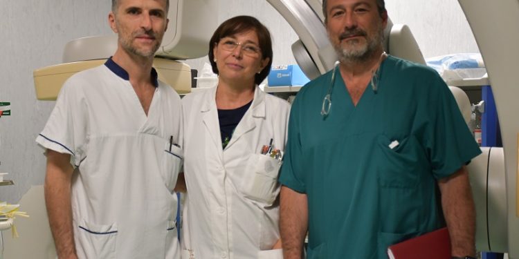 La termoablazione con radiofrequenza per i noduli tiroidei benigni