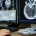 Salute: nuovo trattamento per la cura dei tumori resistenti alla radioterapia