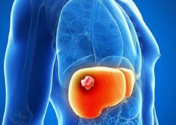 La cura per la Colangite biliare primitiva rischia di non essere più disponibile per i pazienti