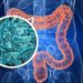NEI BATTERI INTESTINALI IL SEGRETO PER SMASCHERARE IL CANCRO