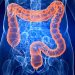 Microbiota e dieta alleati nella prevenzione del tumore al colon-retto
