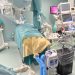 Alla “San Michele” eseguito per la prima volta al mondo un intervento ‘live’ di microchirurgia con metodica dissettiva. Il robot Symani usato in campo oncologico da Vito Del Deo