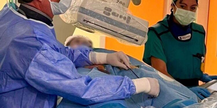 Ad Ariano Irpino il primo intervento in Italia di embolectomia polmonare meccanica con tromboaspirazione manuale