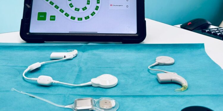 Policlinico Bari, primo impianto cocleare smart per restituire l’udito a un bambino di 11 anni