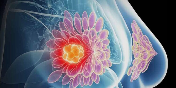 BAMBINO GESÙ DI ROMA SU NATURE MEDICINE LO STUDIO CHE DIMOSTRA L’EFFICACIA DELLE CELLULE CAR-T NELLE MALATTIE AUTOIMMUNI DELL’ETÀ PEDIATRICA