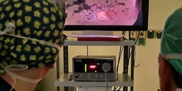 𝗧𝘂𝗺𝗼𝗿𝗲 𝗮𝗹 𝗦𝗲𝗻𝗼. 𝗔𝗻𝗰𝗵𝗲 𝗶𝗻 𝗨𝗺𝗯𝗿𝗶𝗮 𝗺𝗮𝘀𝘁𝗲𝗰𝘁𝗼𝗺𝗶𝗲 𝗺𝗶𝗻𝗶-𝗶𝗻𝘃𝗮𝘀𝗶𝘃𝗲 𝘃𝗶𝗱𝗲𝗼 𝗮𝘀𝘀𝗶𝘀𝘁𝗶𝘁𝗲