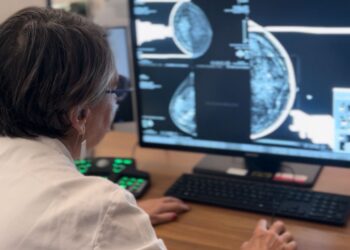 San Camillo-Forlanini di Roma,  mammografia con IA integrata al servizio della diagnosi senologica