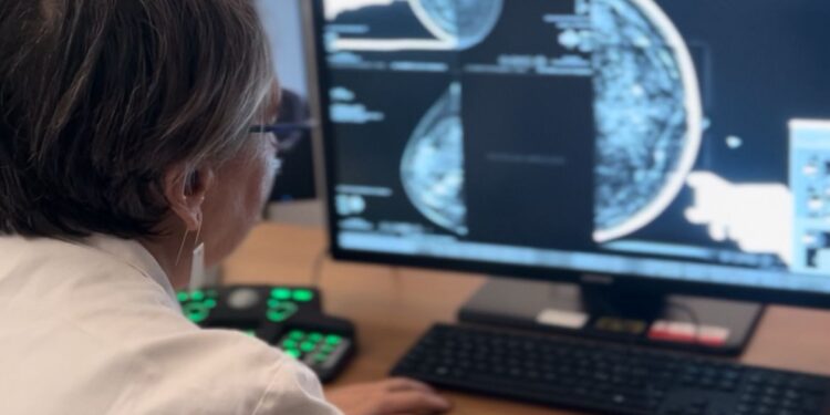 San Camillo-Forlanini di Roma,  mammografia con IA integrata al servizio della diagnosi senologica
