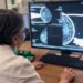 San Camillo-Forlanini di Roma, mammografia con IA integrata al servizio della diagnosi senologica