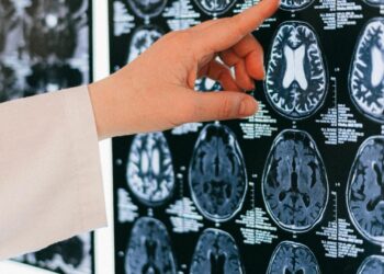 Interventi neurologici più sicuri. Nuova tecnologia all’ospedale di Nuoro dove e’ stato installato un neuronavigatore di ultima generazione