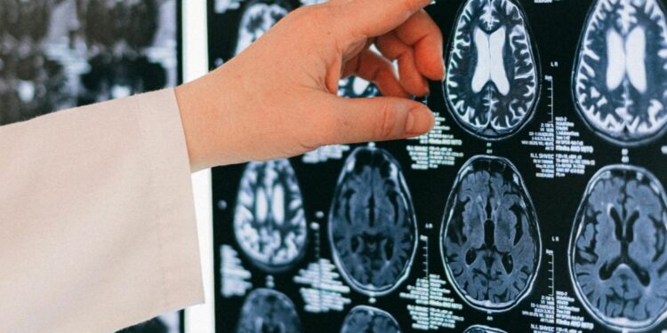 Interventi neurologici più sicuri. Nuova tecnologia all’ospedale di Nuoro dove e’ stato installato un neuronavigatore di ultima generazione