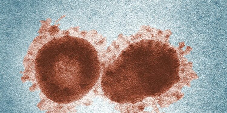 Sospetto caso Ebola a Cagliari. L’uomo presenterebbe sintomi riconducibili al virus
