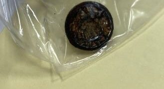 Pile al litio ingerite, dodici casi in 18 mesi al Papa Giovanni XXIII di Bergamo  “Anche senza sintomi chiamate il 112”