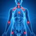 Aor San Carlo di Potenza, al via il nuovo percorso multidisciplinare per i pazienti affetti da fibromialgia