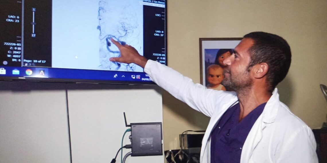 RIMOSSI 4 ANEURISMI CEREBRALI NELLA STESSA SEDUTA OPERATORIA