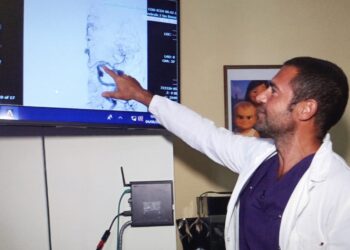 RIMOSSI 4 ANEURISMI CEREBRALI NELLA STESSA SEDUTA OPERATORIA