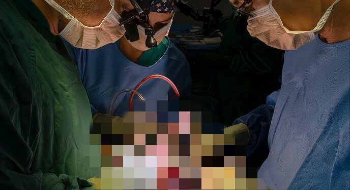 Sostituita valvola a cuore battente senza aprire torace all’ospedale di Pisa. Il paziente a nove mesi dall’intervento presenta un decorso ottimo