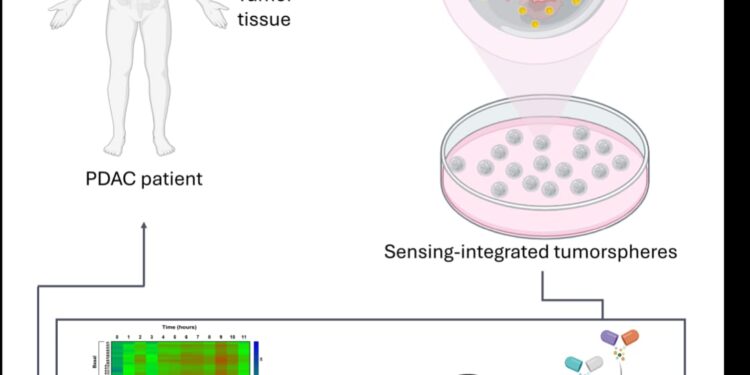 Tumore del pancreas: sensori “intelligenti” nei tessuti misurano la risposta alla chemioterapia