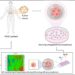 Tumore del pancreas: sensori “intelligenti” nei tessuti misurano la risposta alla chemioterapia